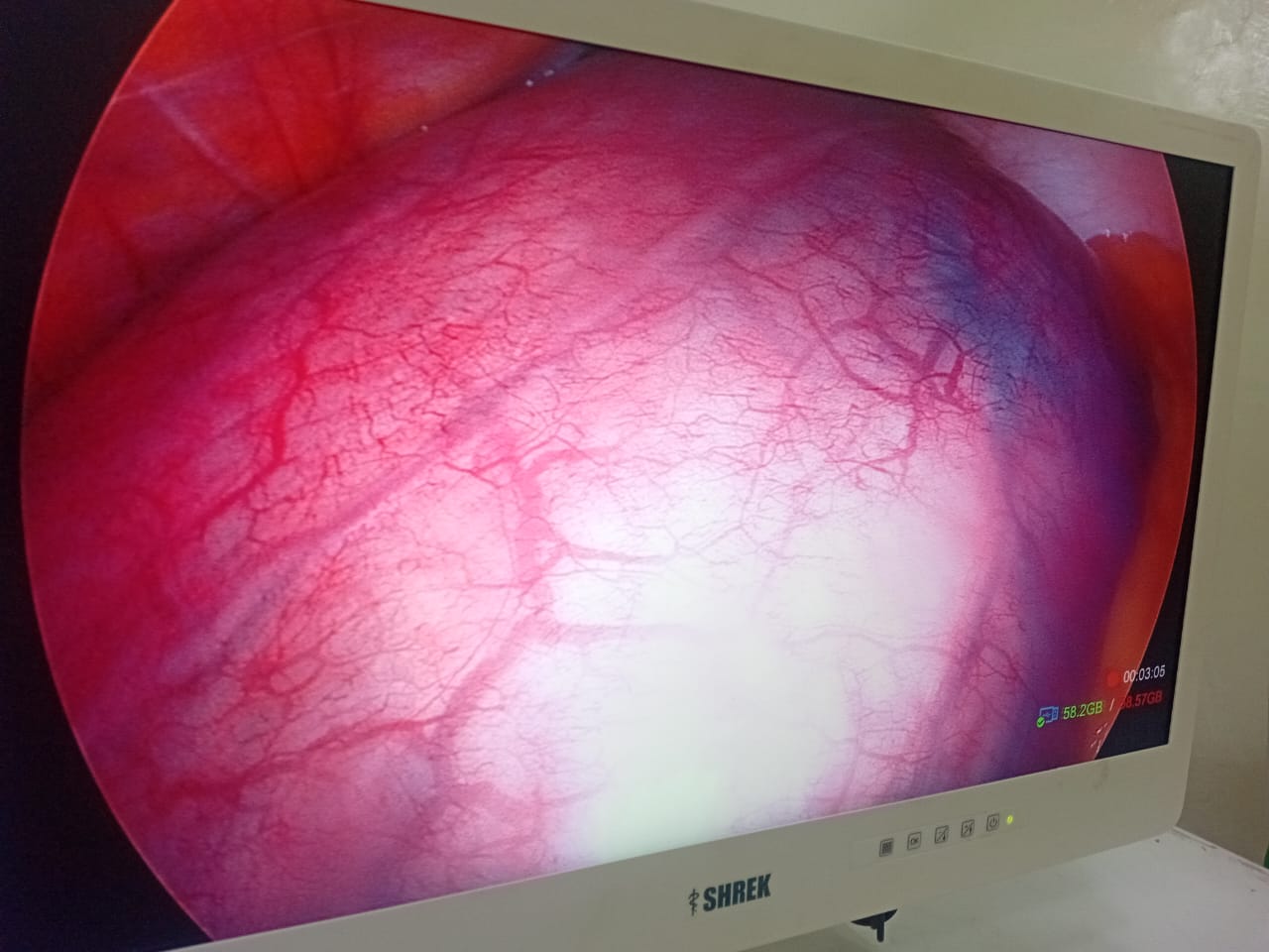 Clear Medical Monitors